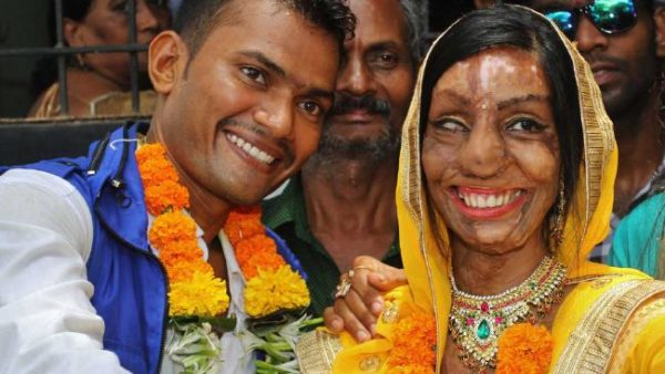 Aaj Ki Naari_Womanhood_Acid Victims-Lalita Ben Bansi