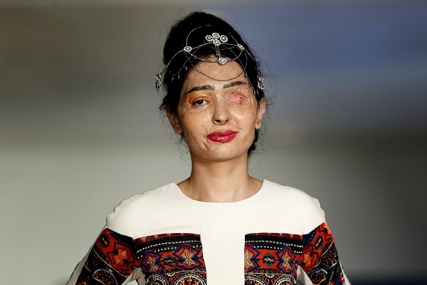 Aaj Ki Naari_Womanhood_Acid Victims-Reshma Qureshi