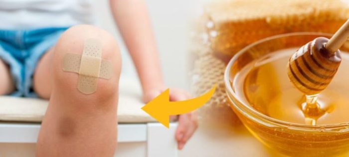 Aaj Ki Naari_Womanhood_Health & Fitness_Benefits of Honey
